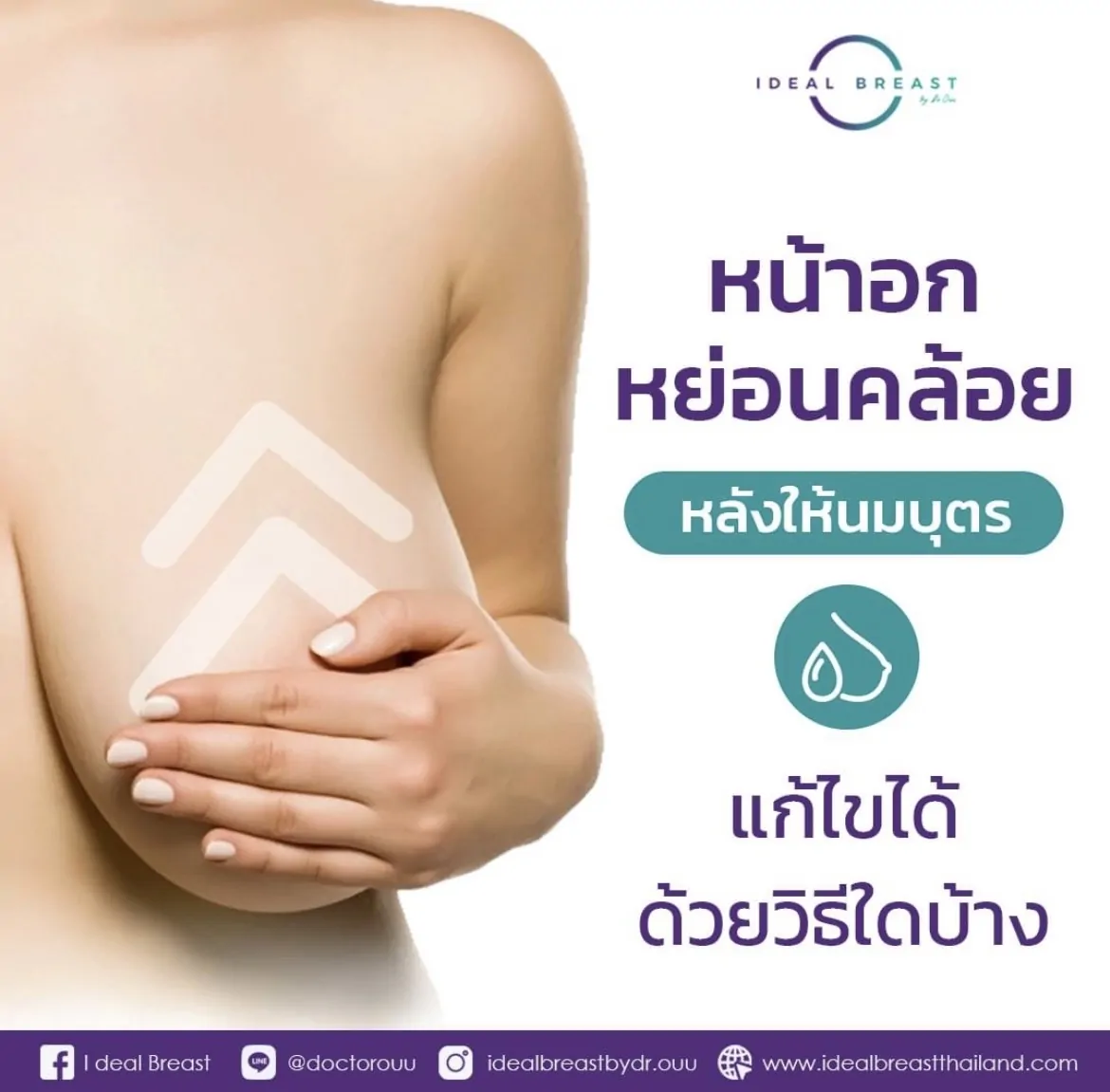 หน้าอกหย่อนคล้อยหลังให้นมบุตร แก้ไขด้วยวิธีใดบ้าง